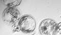 Учени превърнаха стволови клетки в сперматозоиди