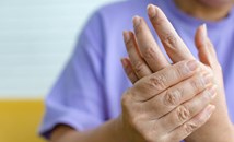 Мравучкане на ръцете: От дефицит на витамини до сигнал за инсулт