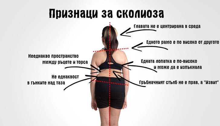 Заболяването, което идва тихо, но се настанява за цял живот Заболяването, което идва тихо, но се настанява за цял живот