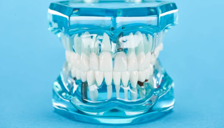 Реминерализация на зъбния емайл е възможна при определени условия Реминерализация на зъбния емайл е възможна при определени условия